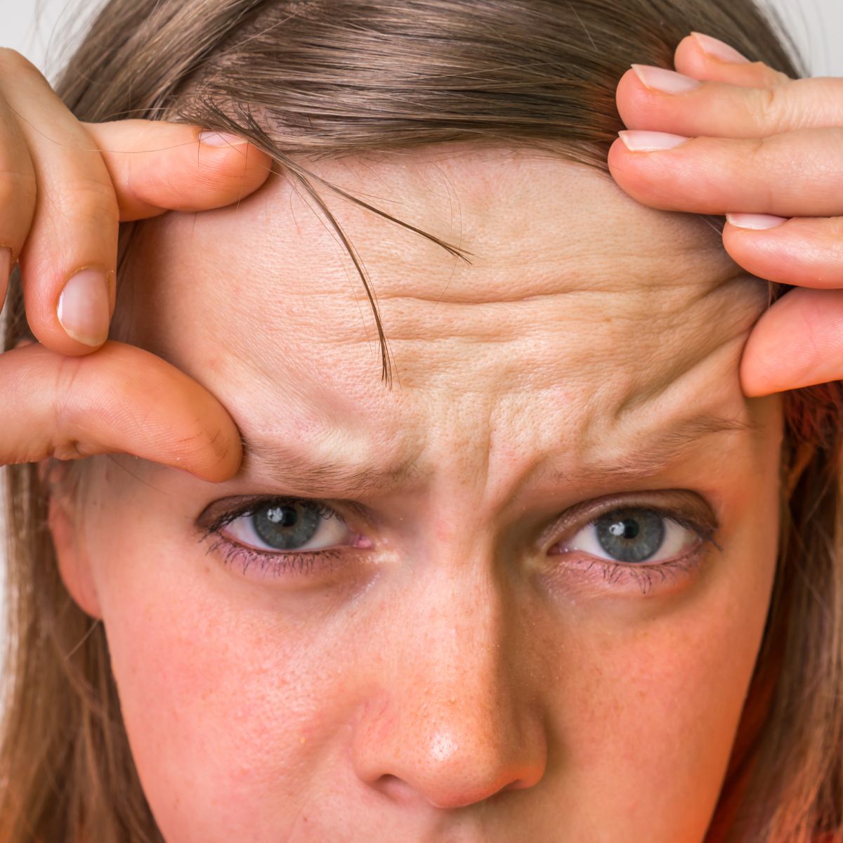 An image of a lady with forehead wrinkles