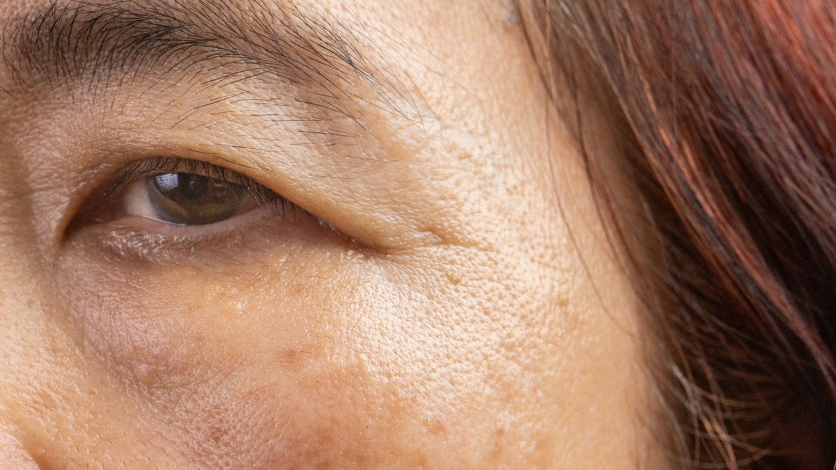 What is the Buzzy Dark Spot Fighting K Beauty Ingredient