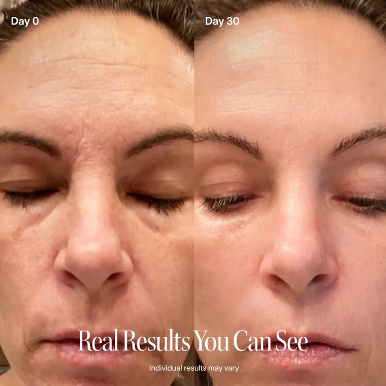 Before and after comparison of a woman's face with text 'Real Results You Can See'.
