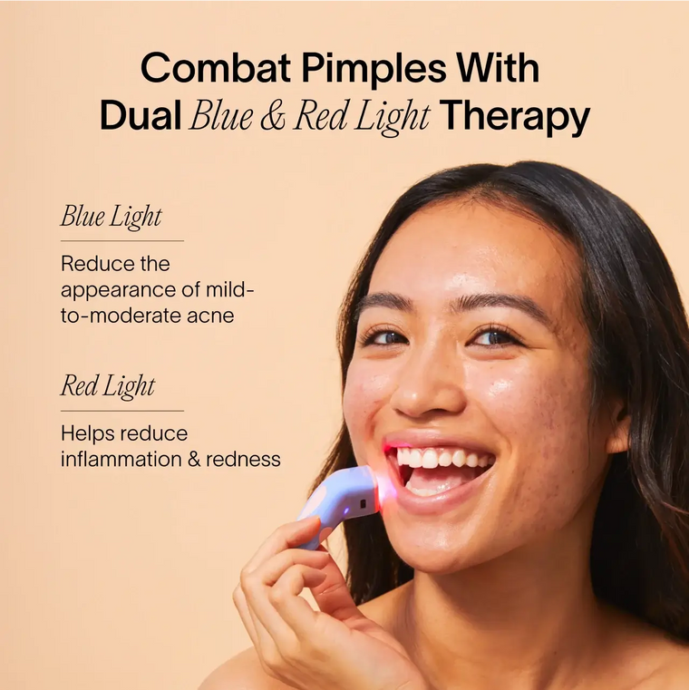 A woman smiles while using the SolaWave Bye Acne: 3-Minute Pimple Spot Treatment device on her face. Text reads, Combat Breakouts With Dual Blue & Red Light Therapy. Blue Light diminishes mild-to-moderate acne; Red Light reduces inflammation and redness. || Periwinkle